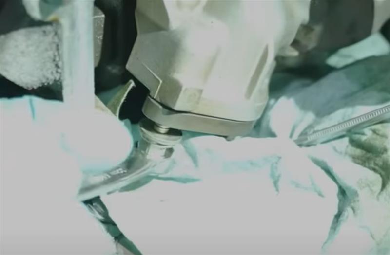 how-to-install-gen-2-coyote-oil-pump-gears-crank-sprocket_be07bbce.jpg (800&times;524)